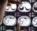 Doctor reading brain MRI x-ray result